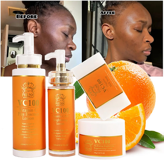 AILKE Vitamin C Whitening 4-in-1 Set, Smooth Skin, Reduce Wrinkles, Black Spots, Moisturizing, With Collagen, Vitamin E