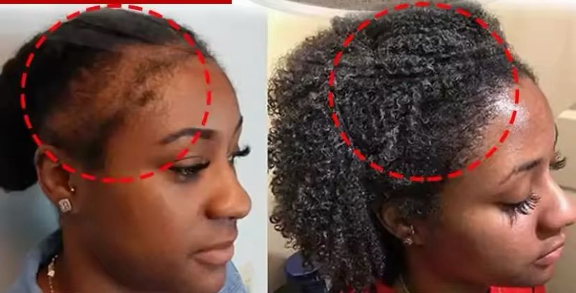 Hair Boost